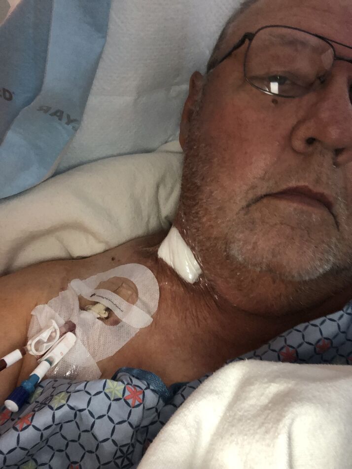 Kidney dialysis port: Got my new port today and they are going to keep ...